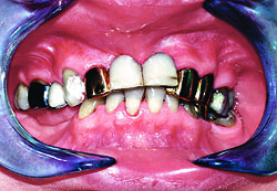 Применение стоматологических лазеров в современной стоматологии