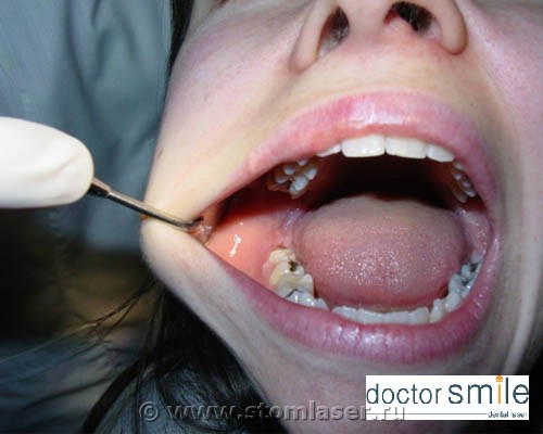     DOCTOR SMILE - 